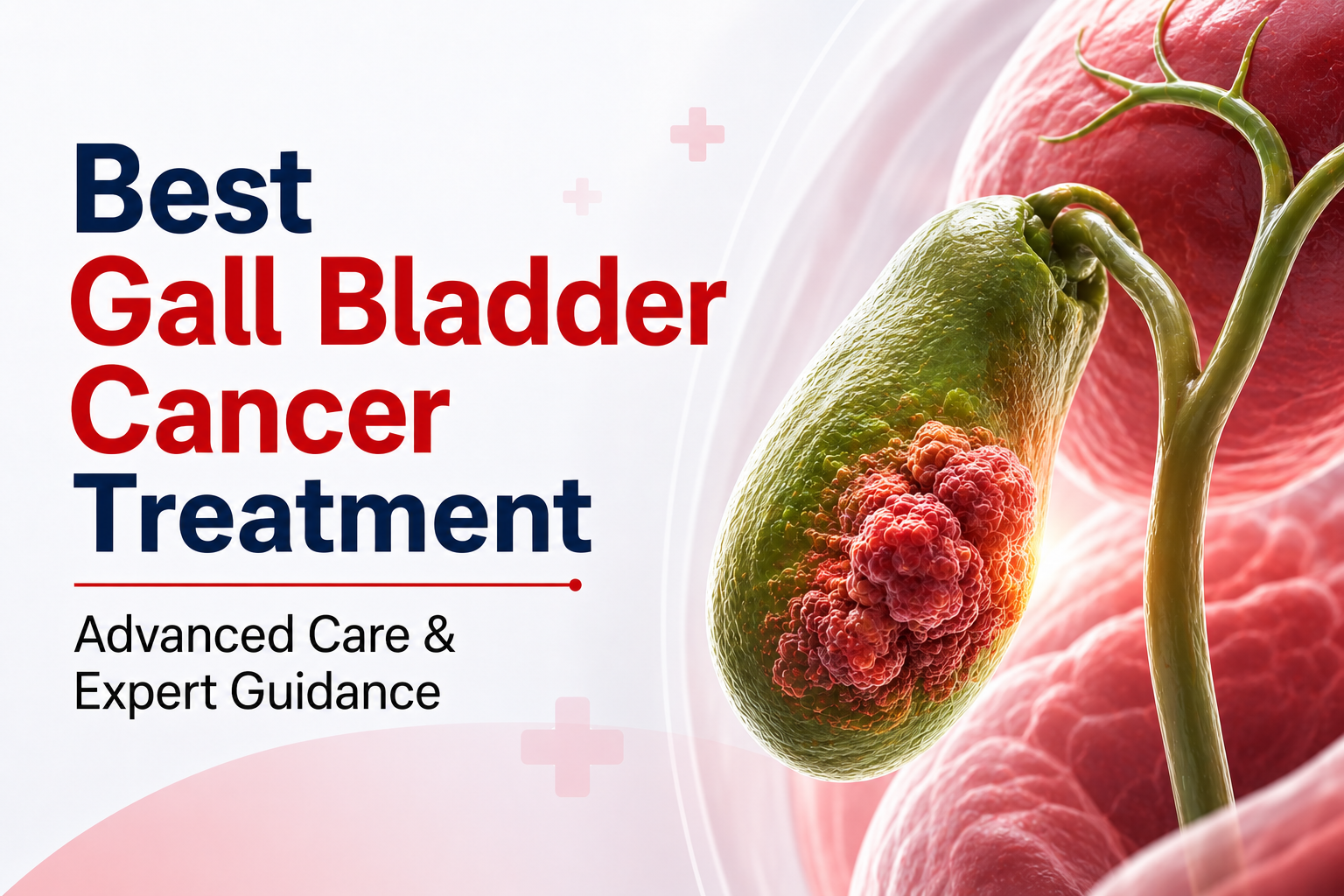 Best Gall Bladder Cancer Treatment in Noida: Choosing the Best Cancer Doctor