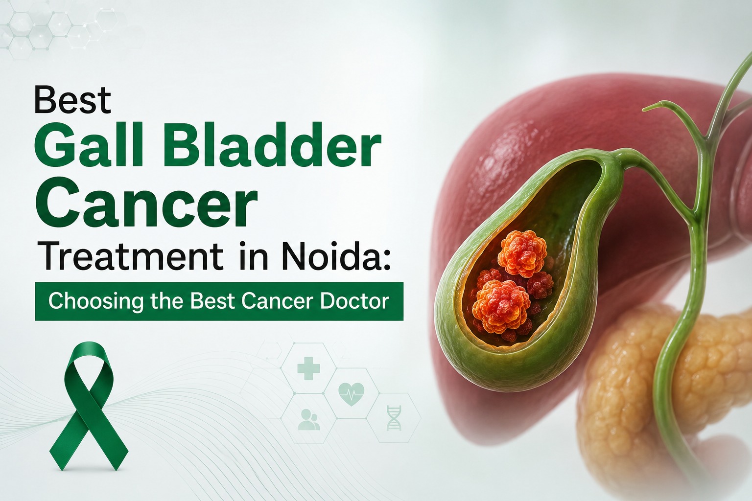 Best Gall Bladder Cancer Treatment in Noida: Choosing the Best Cancer Doctor