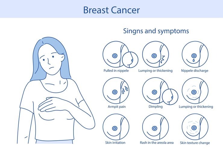 Top 10 Warning Signs of Breast Cancer